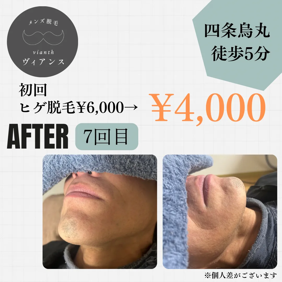ヒゲ脱毛7回目